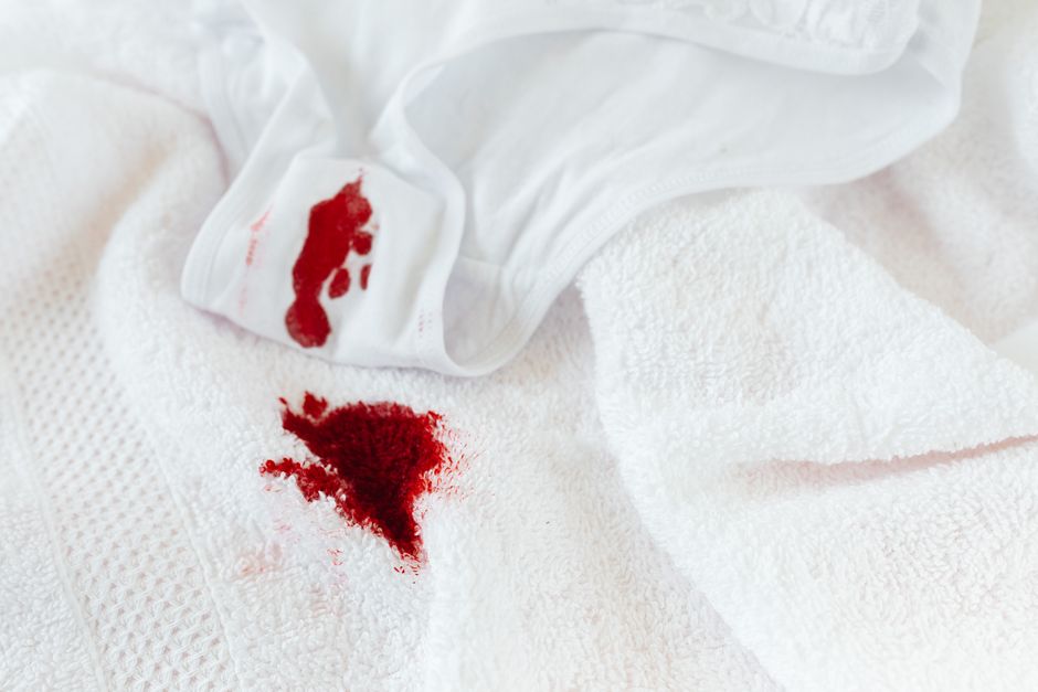 Targeted stain removal on a light carpet